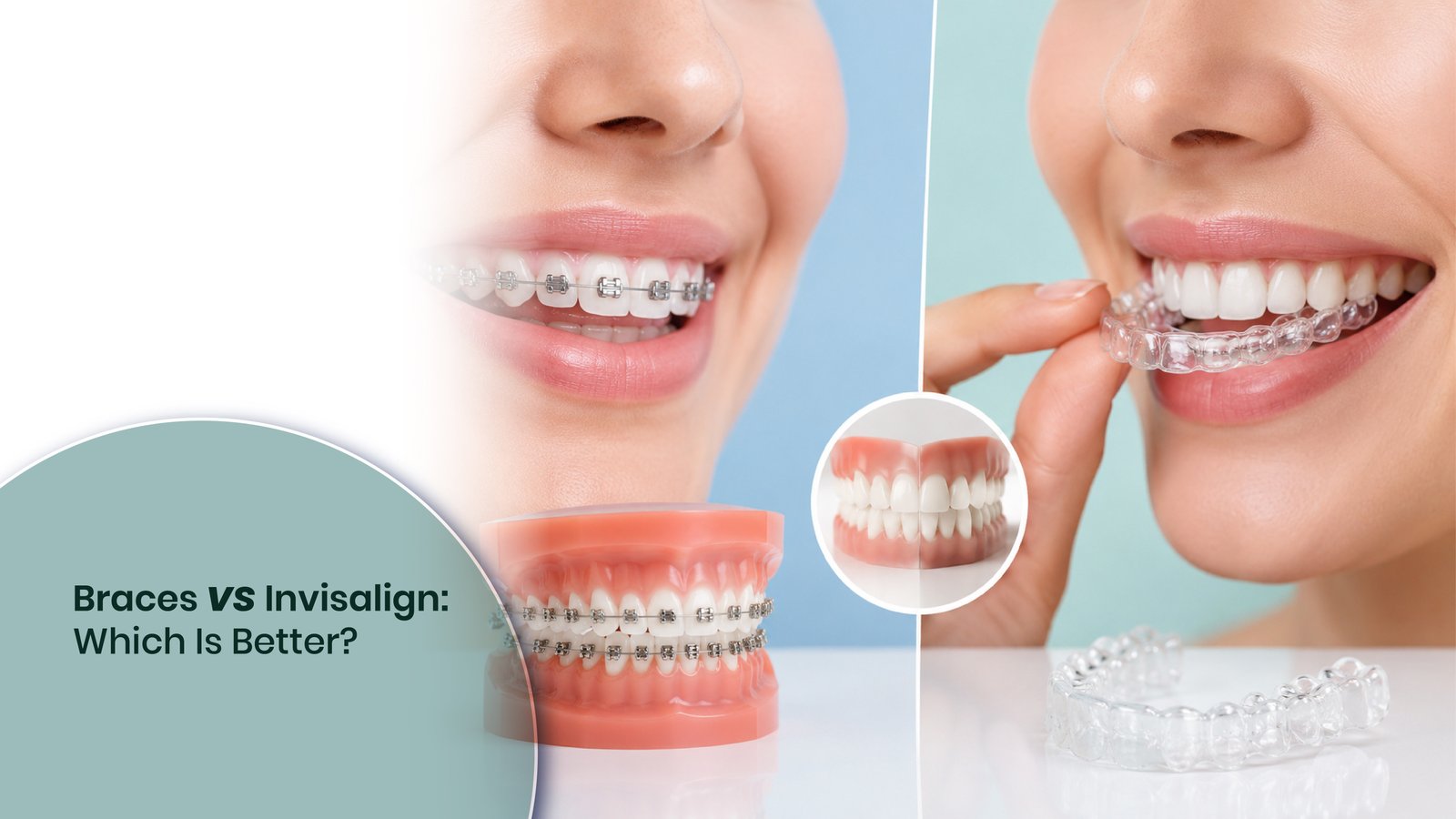 Braces vs Invisalign: Which Is Better?