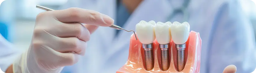 Tooth Implant Procedure