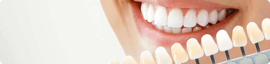 teeth whitening treatment in Ahmedabad