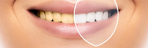 dentist in ahmedabad